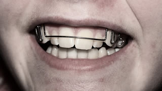 Zahnspange fr Erwachsene  fhrender Experte im Interview